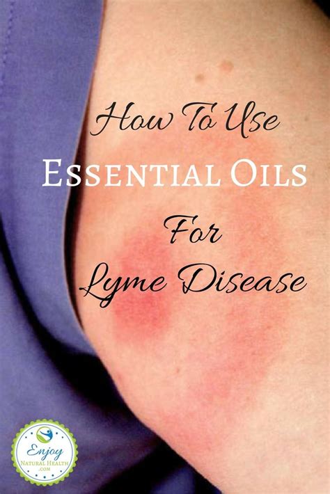 Essential Oils For Lyme Disease Enjoy Natural Health Lyme Disease