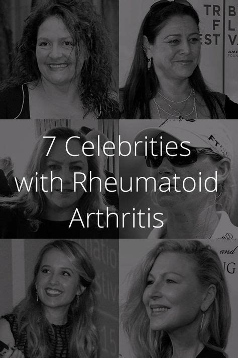 7 Celebrities With Rheumatoid Arthritis