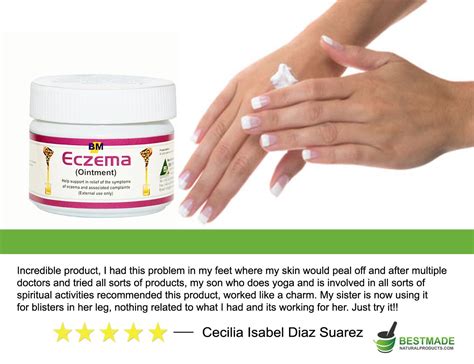 Eczema Ointment 40gm A Natural Treatment For Eczema Psoriasis And