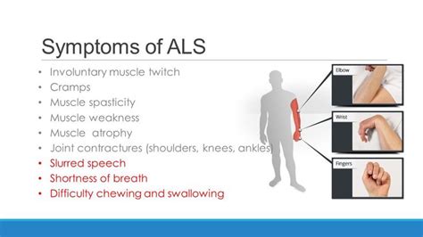 Symptoms Of Als Muscle Twitching Muscle Atrophy Muscle Weakness