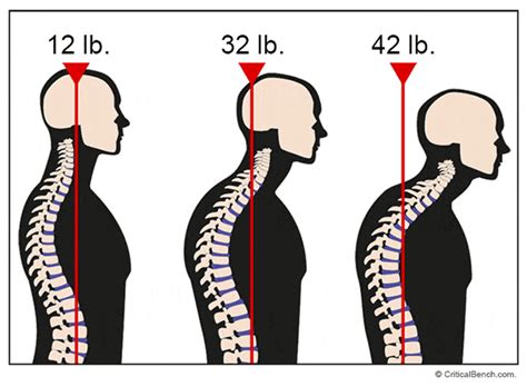Posture correctors can help wit… Forward Head Posture Fix Review: Have Rick Kaselj and Mike ...