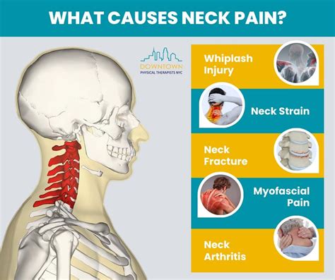 Physical Therapy For Neck Pain Relief Physical Therapists Nyc