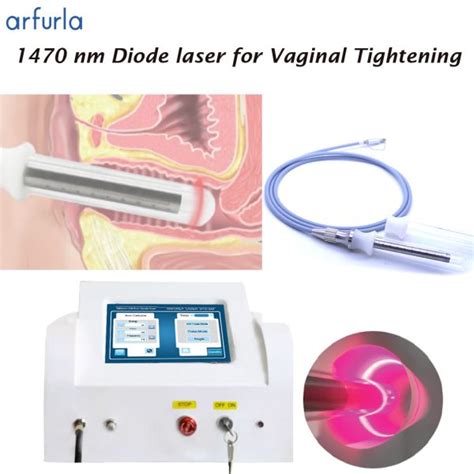 Arfurla1470nm Diode Laser Non Invasive Laseev Solution For Vaginal