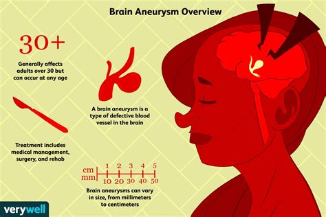 Brain Aneurysms Symptoms Causes Diagnosis And Treatment