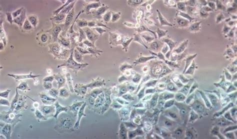 Mycoplasma Contamination Cell Culture Signs