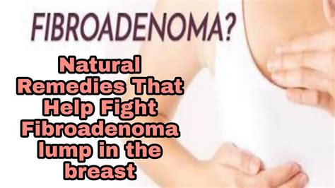 बरसट म गठ Fibroadenoma of the breast Symptoms treatment womenshealthtalk YouTube