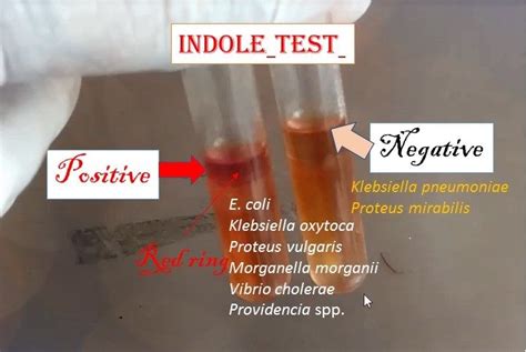 Indole Test Principle And Procedure This Indole Test Is Useful To