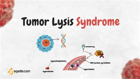 Tumor Lysis Syndrome Trailer