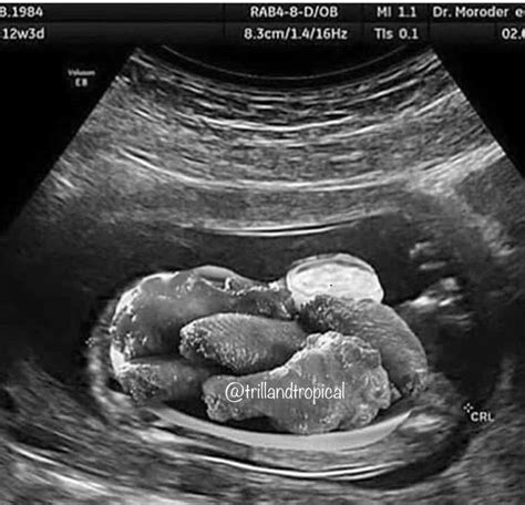 How My Ultrasound Would Look I Love To Laugh Make Me Smile Funny