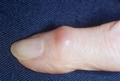These 9 Weird Symptoms Could Be A Sign Of Rheumatoid Arthritis