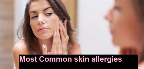 Common Types Of Skin Allergies ~ Healthy Life