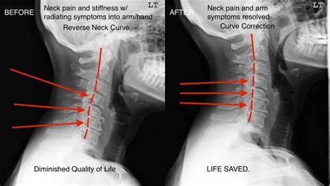Results With Corrective Chiropractic Care Abundant Health Chiropractic