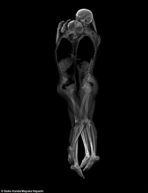 Artists Use X Rays To Take Haunting Photographs Of Couples In An Embrace Daily Mail Online