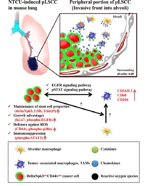 Working Model Of Peripheral Type Lung Squamous Cell Carcinoma Plscc