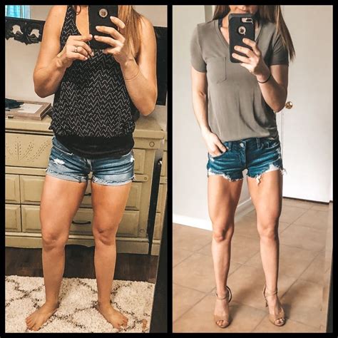 Walking Before And After Legs