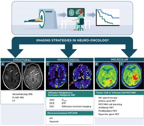 Overview Of Imaging Techniques Used To Predict Response To