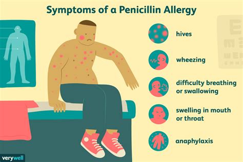 Penicillin Allergy Pictures