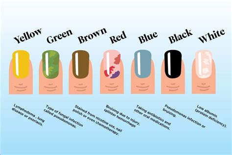 What Your Nail Color Says About Your Health Readers Digest