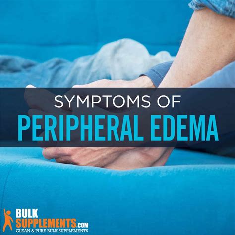 Peripheral Edema Symptoms Causes And Treatment By James Denlinger
