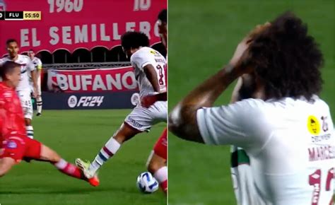 Versus La escalofriante lesión que sufrió un jugador de Argentinos Juniors en la Copa Libertadores