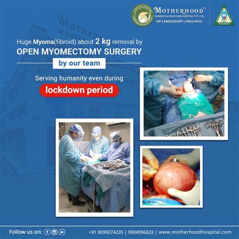 Huge Myoma Fibroid About Kg Removal By Open Myomectomy Surgery By Our Team Serving Humanity