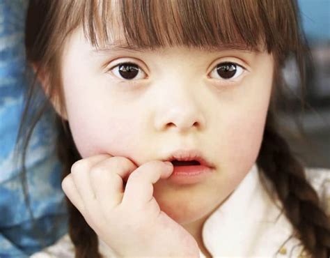 Myths And Truths About The People With Down Syndrome