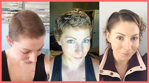 My Tips For Hair Growth Post Chemo Rethink Breast Cancer