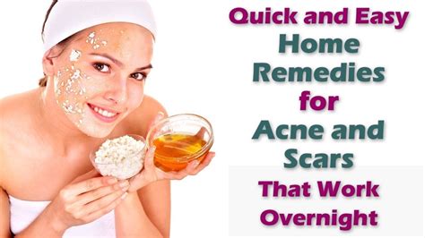 How To Get Rid Of Acne Scars In 3 Days How To Prevent Acne And Pimple Naturally In 3 Days