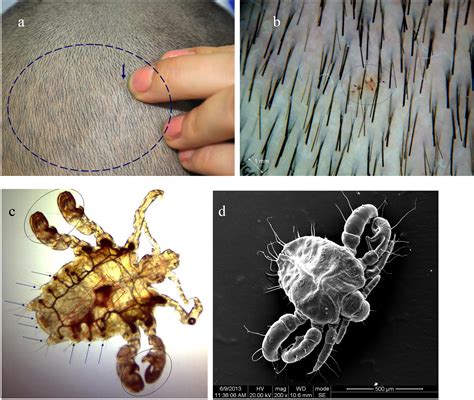 Electron Microscope Eyebrow Bugs Micropedia