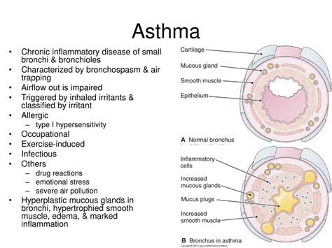 Ppt Diseases Of The Respiratory System Powerpoint Presentation Id