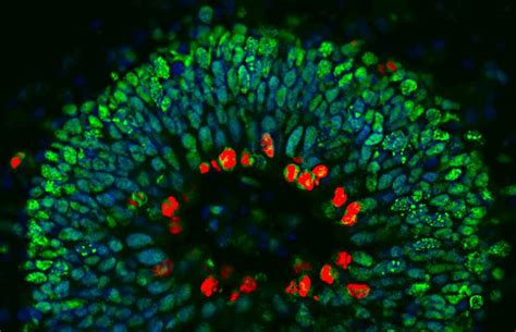 Section Through A Human Brain Image Eurekalert Science News Releases