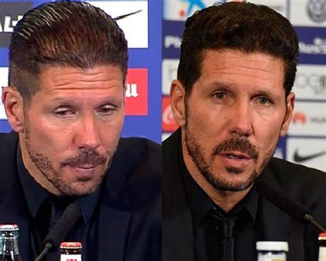 Entrenador del todopoderoso atlético de madrid, forjando un equipo fuerte, aguerrido y contragolpeador. Estos son algunos famosos que sufren alopecia | TenerPelo.
