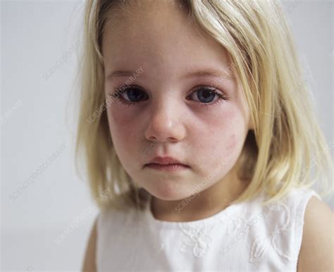Upset Young Girl Stock Image M8301494 Science Photo Library