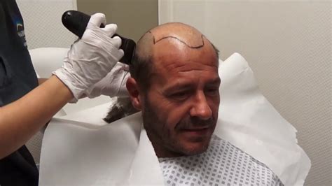 Schauspieler willi herren ist tot. Haartransplantation Willi Herren - YouTube