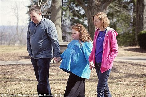 Alexis Shapiro Who Had Gastric Bypass Surgery After Brain Tumor Op