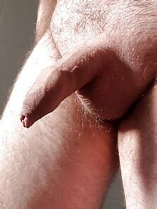 Foreskin Pictures Search Galleries