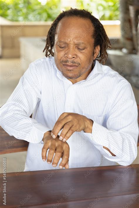 Middle Age African Man Scratching Suffering From Itching Hand Skin