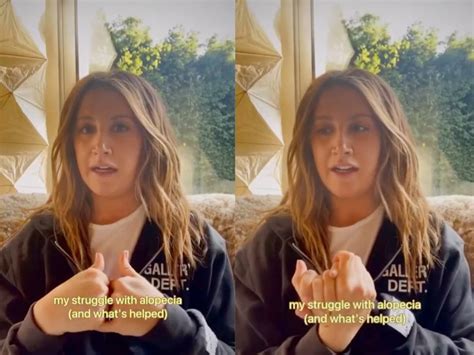Ashley Tisdale Opens Up About Alopecia Struggle ‘it’s Nothing To Be Ashamed Of’ The Independent