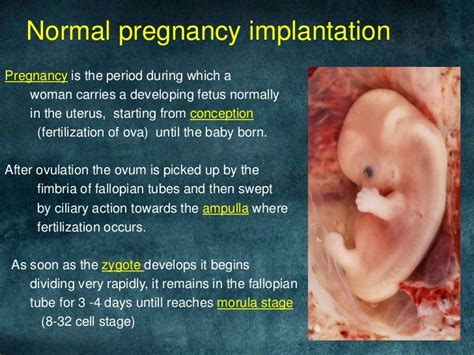 What Is Bleeding Like With Ectopic Pregnancy Pregnancywalls