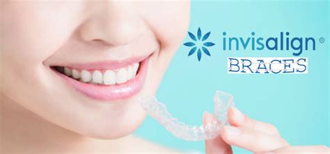 Invisalign Braces How The Latest Adult Braces Can Help You Smile Better