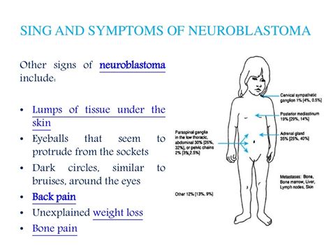 Neuroblastoma Patient Info On Symptoms Diagnosis And Treatment Opti