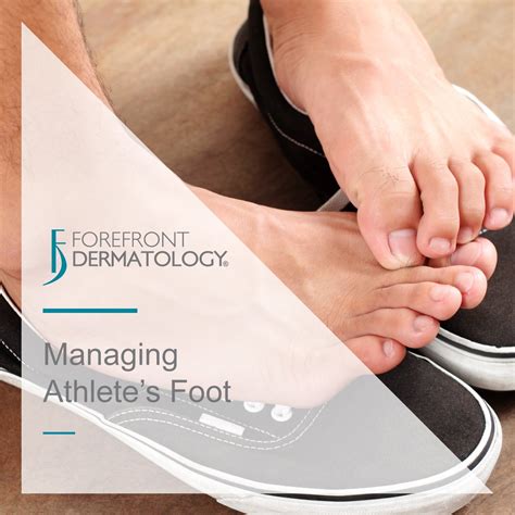 Managing Athletes Foot Forefront Dermatology
