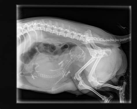 An X Ray Of Our Little Lilly While Pregnant Atheist Pregnant X Ray
