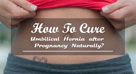 Hernia After Pregnancy Pregnancywalls