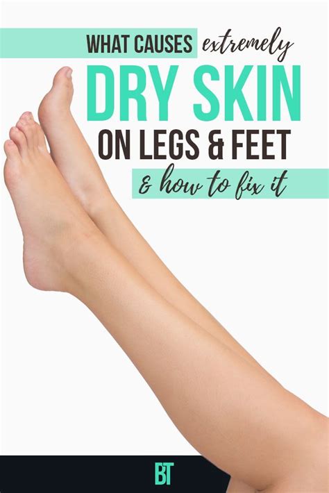 What Causes And How To Treat Dry Skin On Legs Skin Care Tips Dry Skin