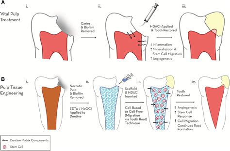 Frontiers Epigenetic Approaches To The Treatment Of Dental Pulp