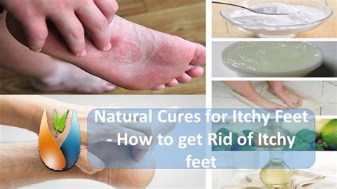 Foot Itching Remedies Foot Care Tips