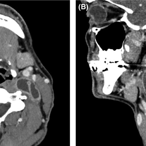 A Axial And B Sagittal Contrast‐enhanced Computed Tomography