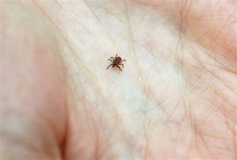 Did You Get Bit By A Lyme Infested Tick Heres What To Do Wbur