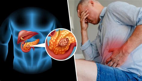 Consult a doctor for medical advice. Pancreatic cancer - % % Priya Hospital